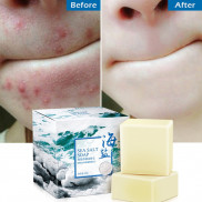 Xà phòng muối biển rửa mặt/tẩy trang/tẩy mụn đầu đen/trứng cá 100g
