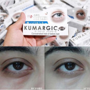 KEM HỖ TRỢ GIẢM THÂM MẮT KUMARGIC EYE